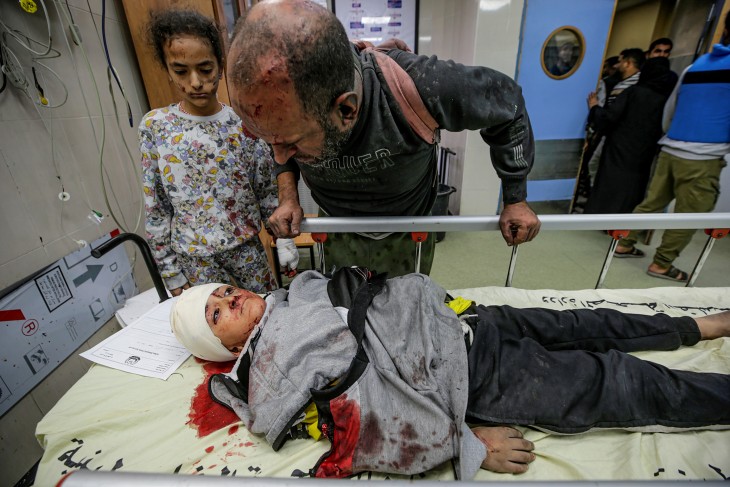 Sebesült palesztin család a Nasser kórházban Khan Younisban egy izraeli légicsapás után 2023. november 15-én. Fotó: EPA/MOHAMMED SABER