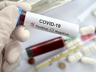 Koronavírus:  elhunyt újabb 56 beteg 