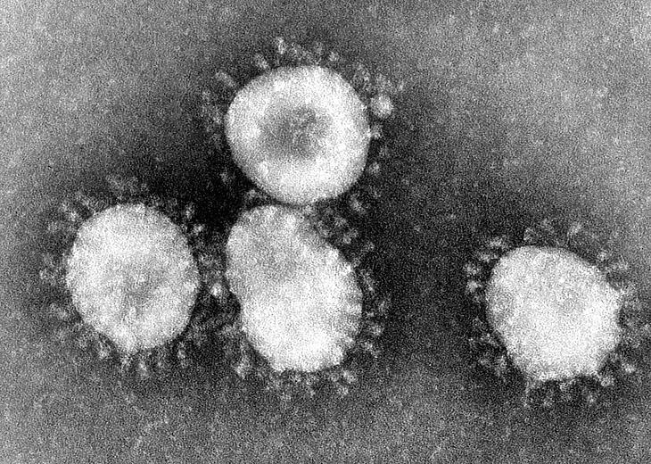  A SARS-CoV humán koronavírus. Forrás: Centers for Disease Control/Prevention's Public Health Image Library/Dr. Fred Murphy. Képazonosító: #4814. Közkincs, https://commons.wikimedia.org/w/index.php?curid=822112