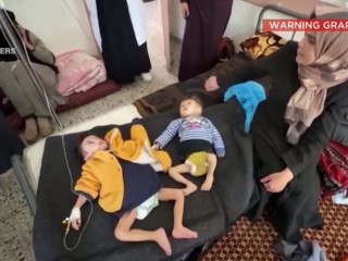 Éhező gyerekek a  Kamal Adwan kórházban, 2023. március 7. Fotó: CNN/printscreen