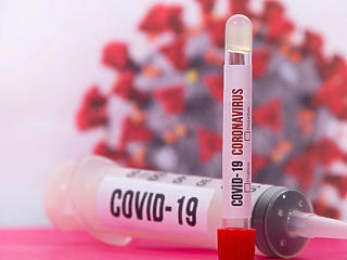 Koronavírus: 35 millióhoz közelít a fertőzöttek száma