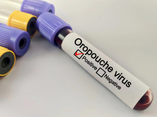 Az Oropouche-vírussal való fertőzöttséget laboratóriumi teszt segítségével lehet kimutatni
