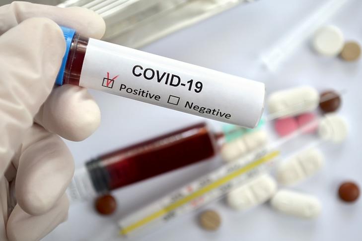 Bejelentették: a teljes szlovák lakosságot letesztelik koronavírusra
