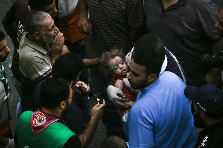 Palesztinok visznek be az Al-Shifa kórházba egy sérült kisgyereket az izraeli légicsapások után Gázavárosban. Fotó: EPA/HAITHAM IMAD