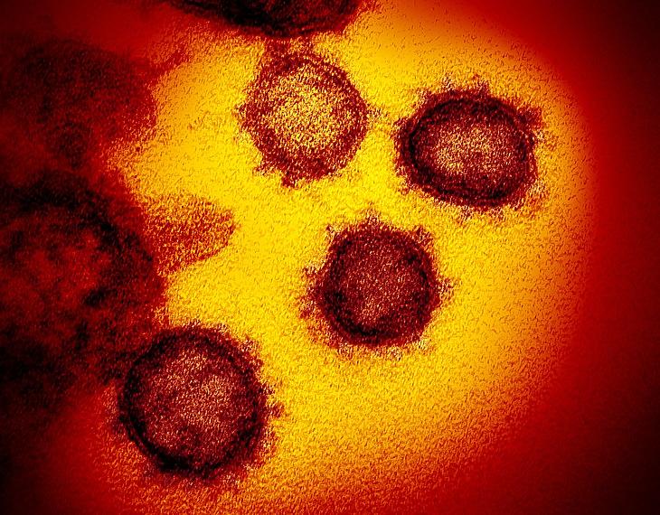 A SARS-CoV-2 humán koronavírus pásztázó elektronmikroszkópos képe. Készítette: NIAID 