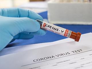 Itthon is egyre gyorsabb koronavírus tesztek jönnek